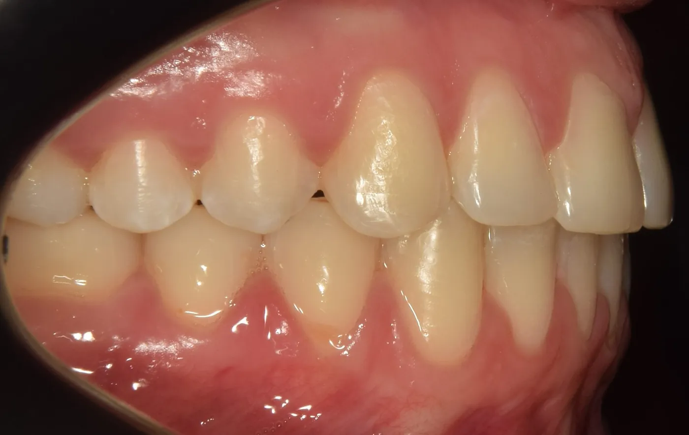 Az ideális, harmonikus fej-nyaki komplexum jellemzői – 4. kép