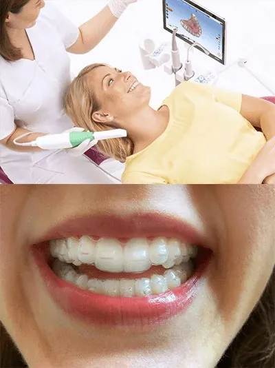 Ha mindennel készen vagyunk, akkor indulhat a láthatatlan fogszabályozós kezelés (Invisalign/Happysmile)!