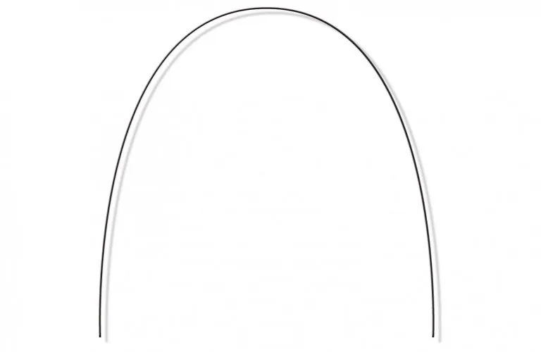 Nikkel-titánium ív – fogszabályozási fogalom illusztrációja